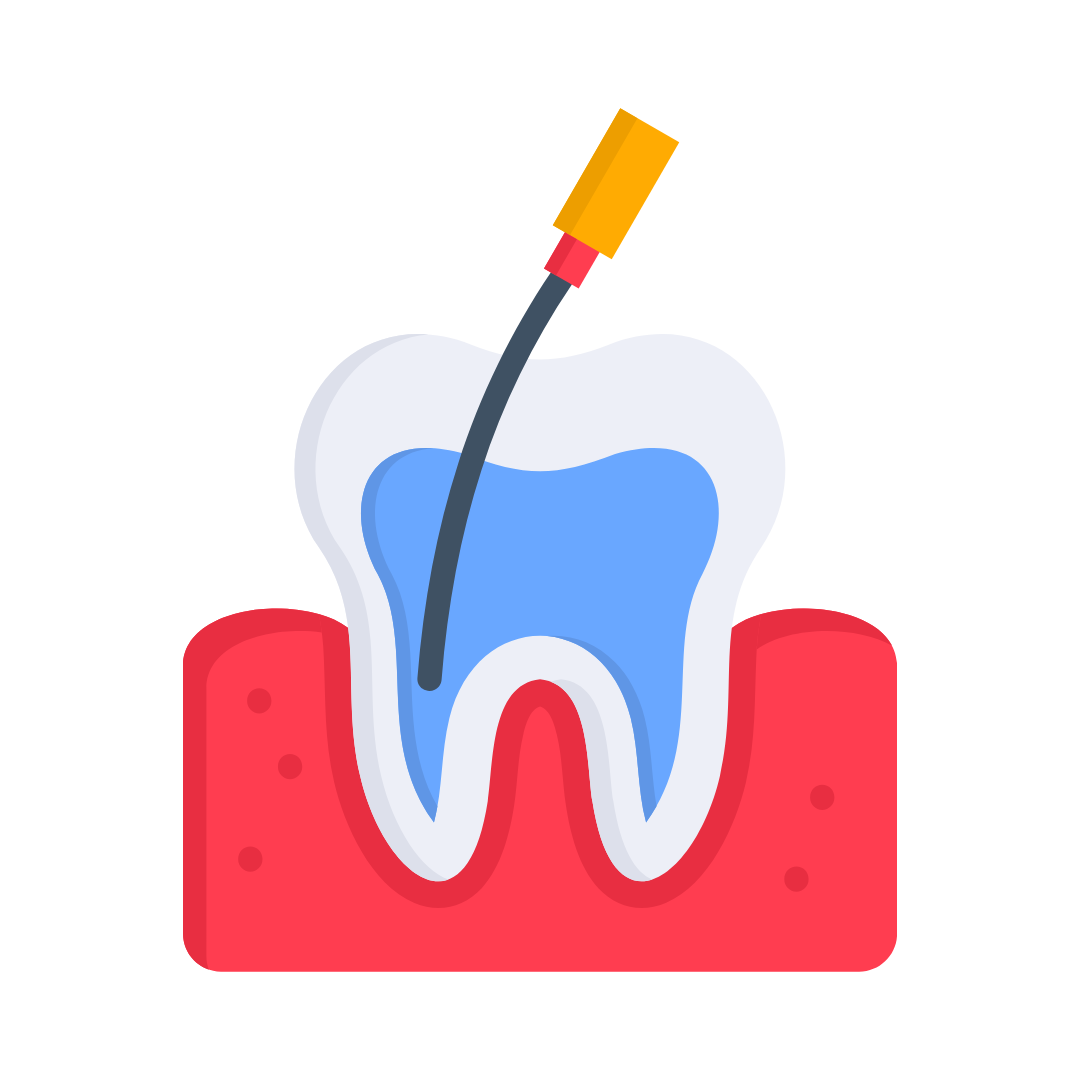  Tratamento de canal em dentes de leite